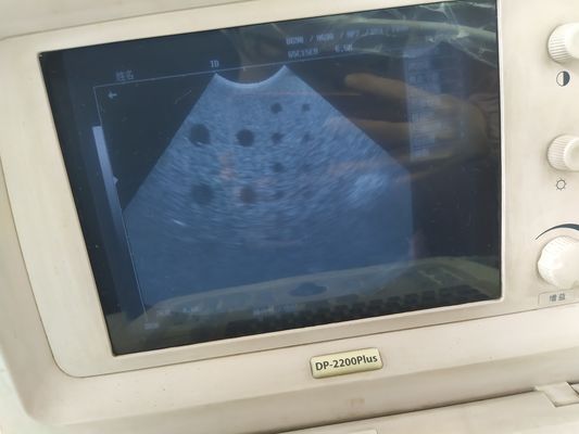 Classe II Ultrasuoni Mindray Esperti Scanner di gravidanza 65C15EA Microconvex sonda per l'imaging